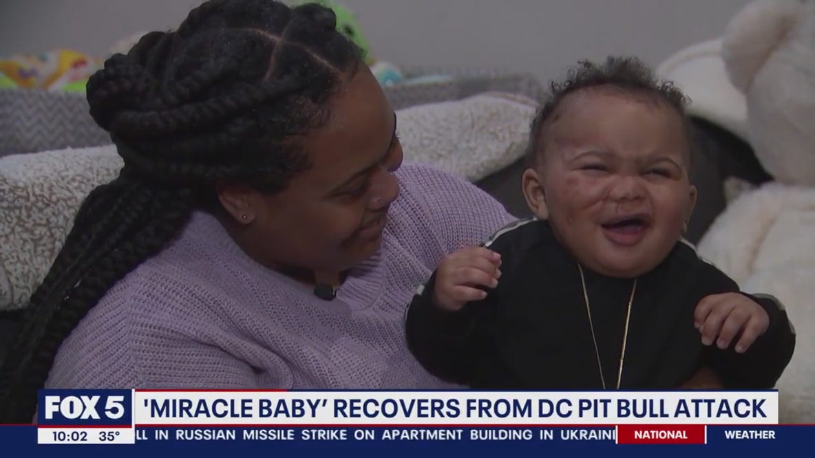 'Miracle baby' recovers from pit bull attack in DC